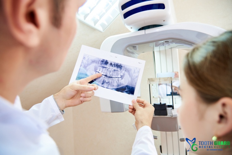 Intraoral scanner price (Digital Scanner)
&nbsp;